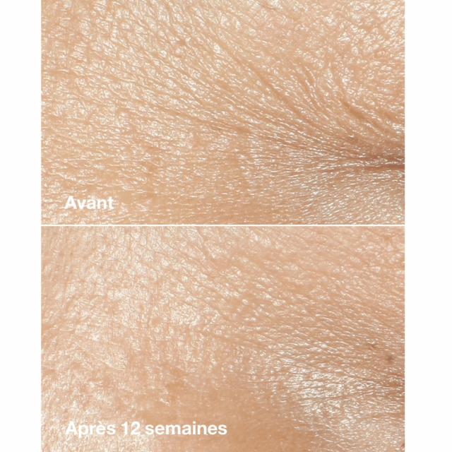 Smart Clinical Repair | Crème Riche Correctrice Anti-Rides