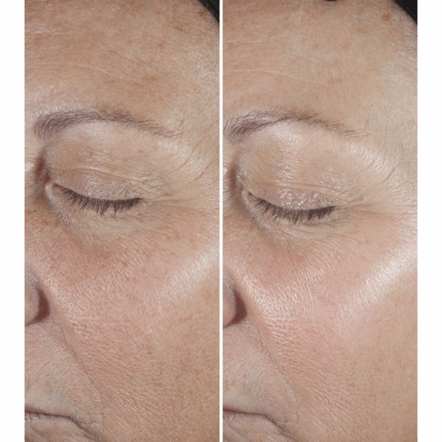 Smart Clinical Repair | Sérum Correcteur Anti-Rides
