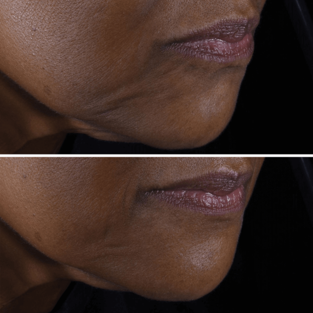 Smart Clinical Repair | Crème liftante visage et cou