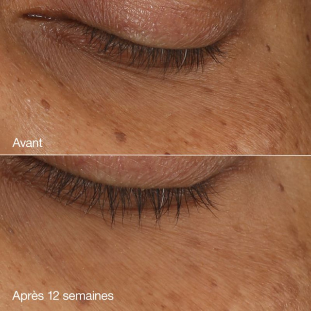 All About Eyes | Sérum concentré illuminateur